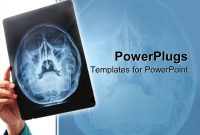Radiology Powerpoint Templates X Ray Powerpoint Template  Mandegar inside Radiology Powerpoint Template